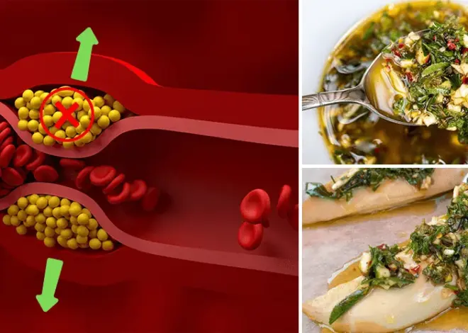 Cholesterol: Pharmaceutical Companies Bet on ‘s Lesser-Known Form, Lp(a)