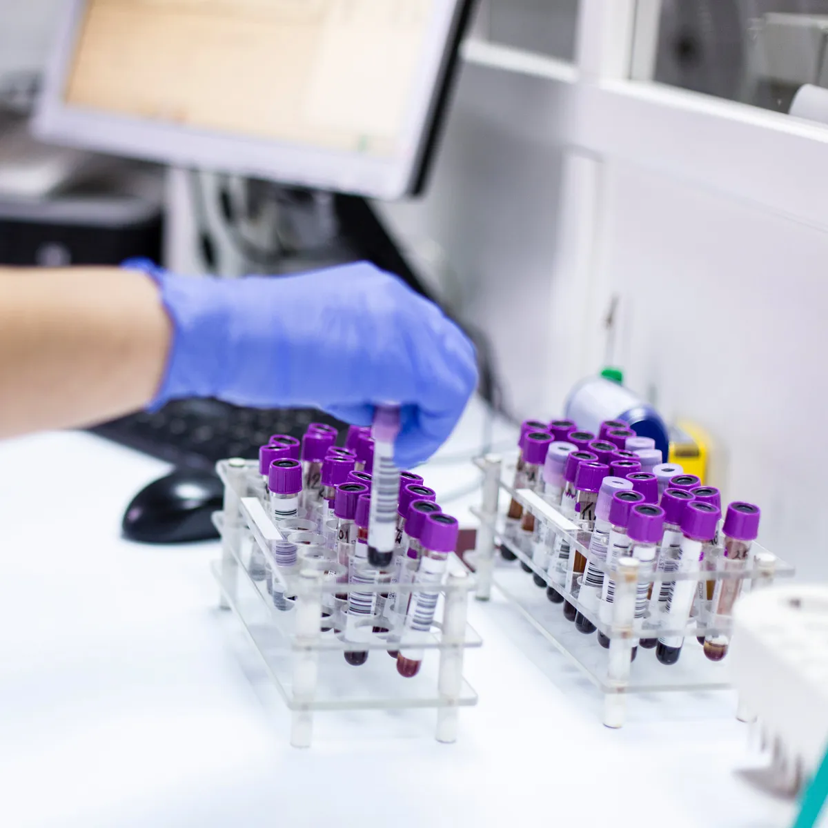 Colorectal Cancer: Alarming Rise Among Young Adults