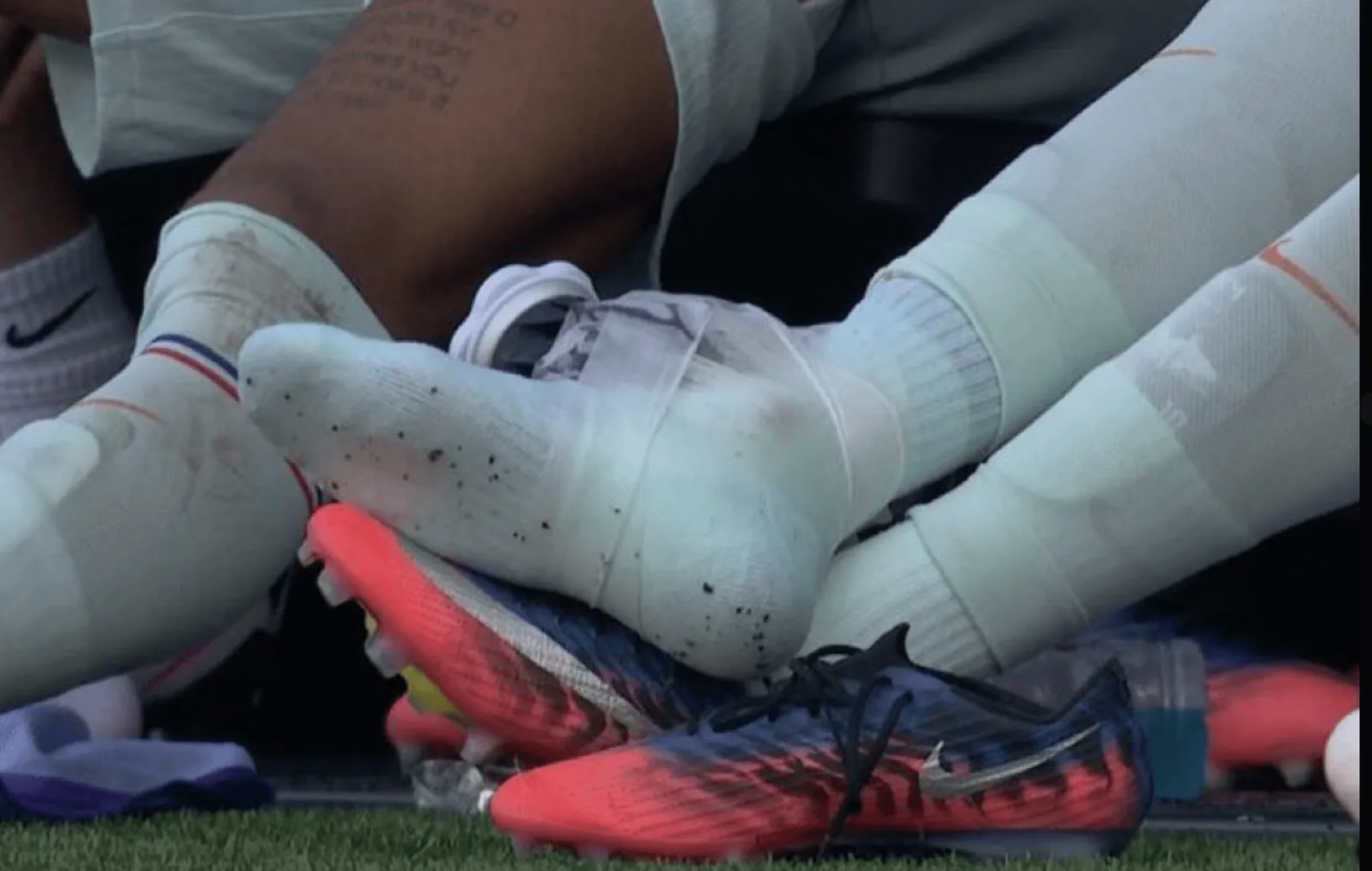 Mbappe's foot strapped with ice